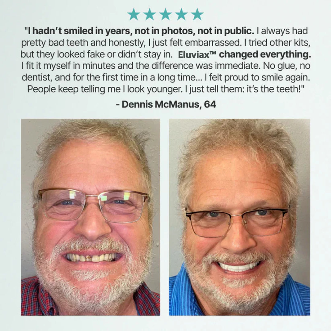 🌎Ends Today: Ends Today: 70% OFF! ⏰Eluviax® Medical Full Denture with Strong Suction🦷“Get Your Natural Smile Back — No Expensive Dental Work Needed”