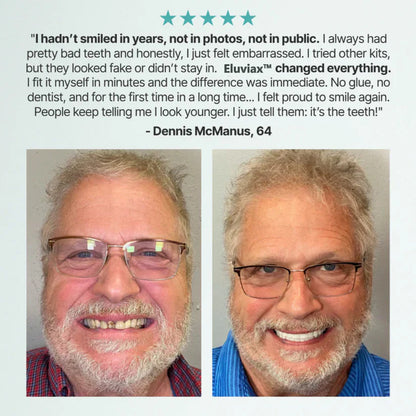 🌎Ends Today: Ends Today: 70% OFF! ⏰Eluviax® Medical Full Denture with Strong Suction🦷“Get Your Natural Smile Back — No Expensive Dental Work Needed”