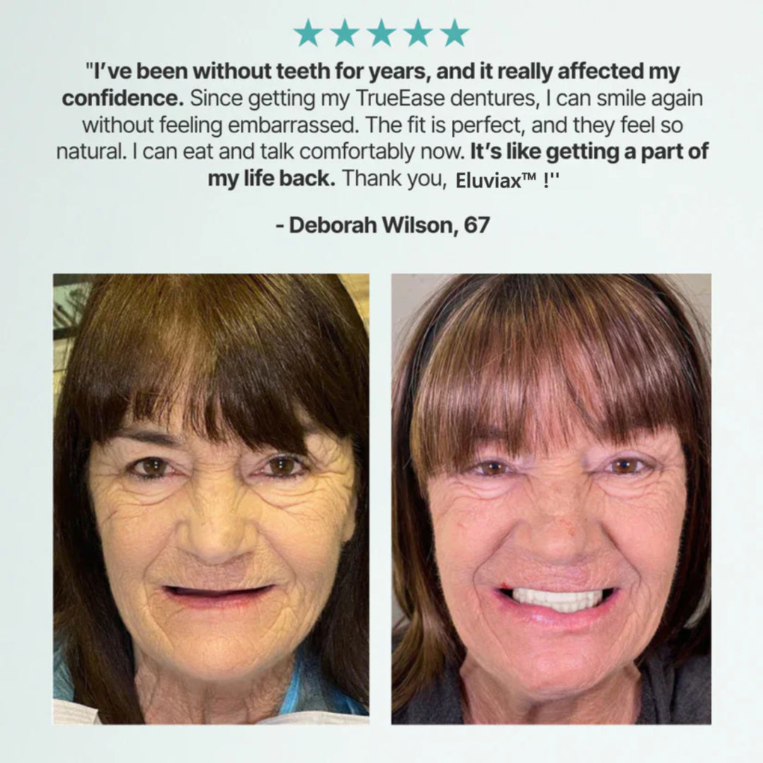 🌎Ends Today: Ends Today: 70% OFF! ⏰Eluviax® Medical Full Denture with Strong Suction🦷“Get Your Natural Smile Back — No Expensive Dental Work Needed”