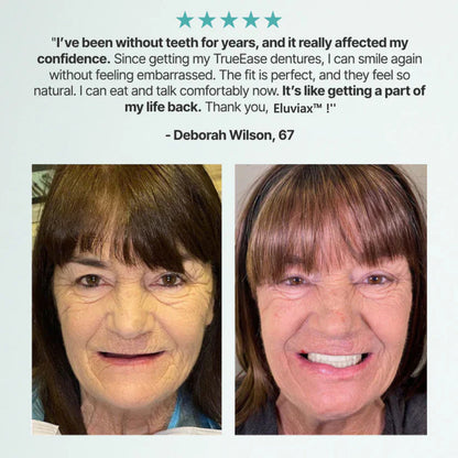 🌎Ends Today: Ends Today: 70% OFF! ⏰Eluviax® Medical Full Denture with Strong Suction🦷“Get Your Natural Smile Back — No Expensive Dental Work Needed”