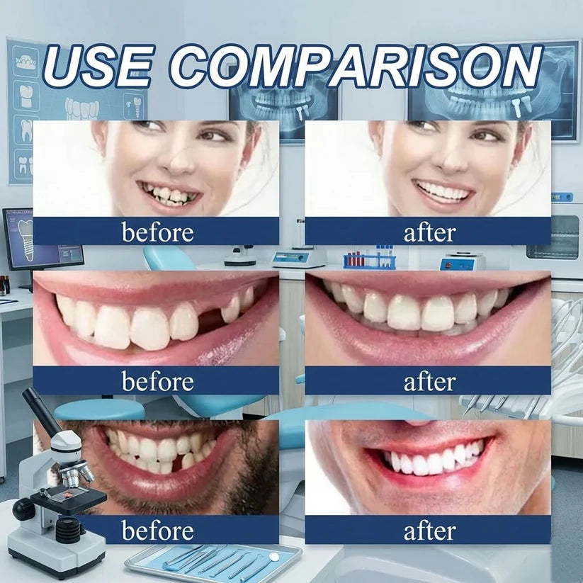 🌎Ends Today: Ends Today: 70% OFF! ⏰Eluviax® Medical Full Denture with Strong Suction🦷“Get Your Natural Smile Back — No Expensive Dental Work Needed”