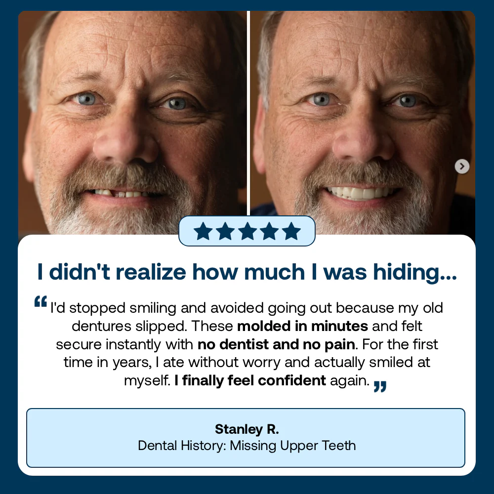 🌎Ends Today: Ends Today: 70% OFF! ⏰Eluviax® Medical Full Denture with Strong Suction🦷“Get Your Natural Smile Back — No Expensive Dental Work Needed”