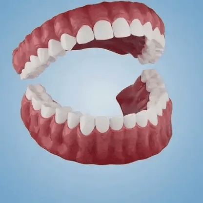 🌎Ends Today: Ends Today: 70% OFF! ⏰Eluviax® Medical Full Denture with Strong Suction🦷“Get Your Natural Smile Back — No Expensive Dental Work Needed”